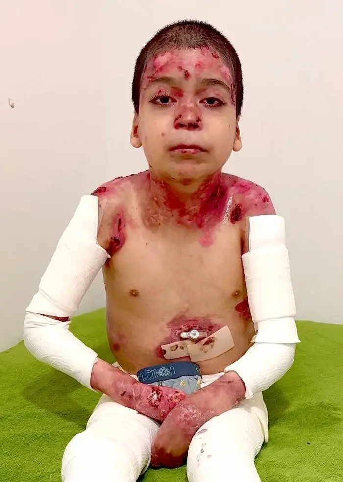 ¡Ayuda ahora al Niño Jesús a aliviar su terrible dolor!